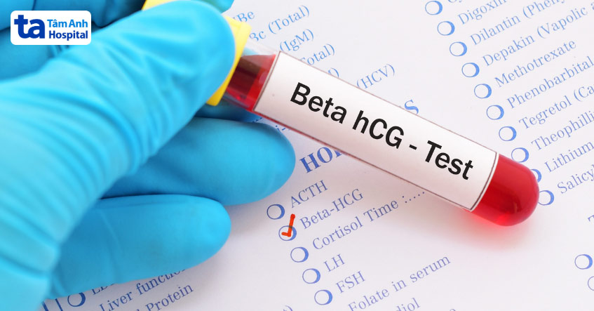 Xét nghiệm định lượng beta hCG là thước đo chính xác nhất để biết mang thai hay không sau chuyển phôi