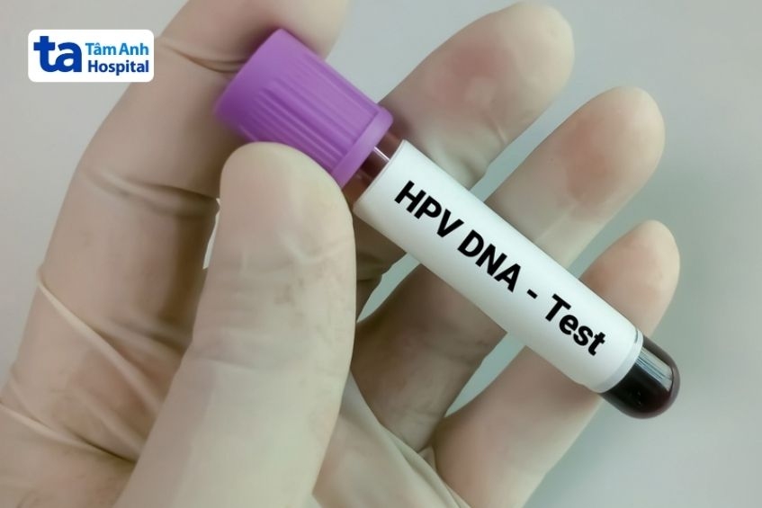 xét nghiệm hpv dna test cho phụ nữ