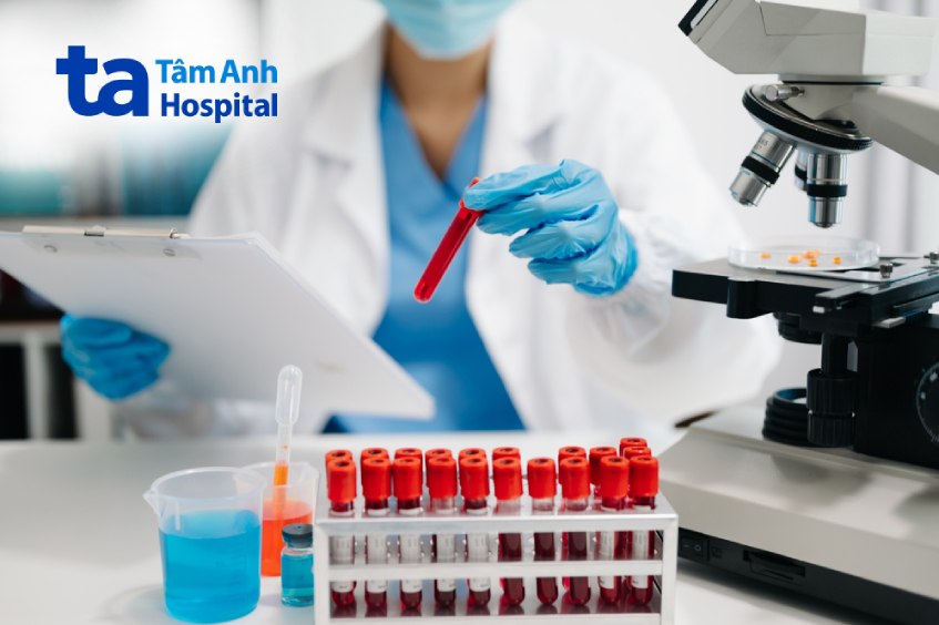 xét nghiệm kiểm tra viêm thanh quản mạn