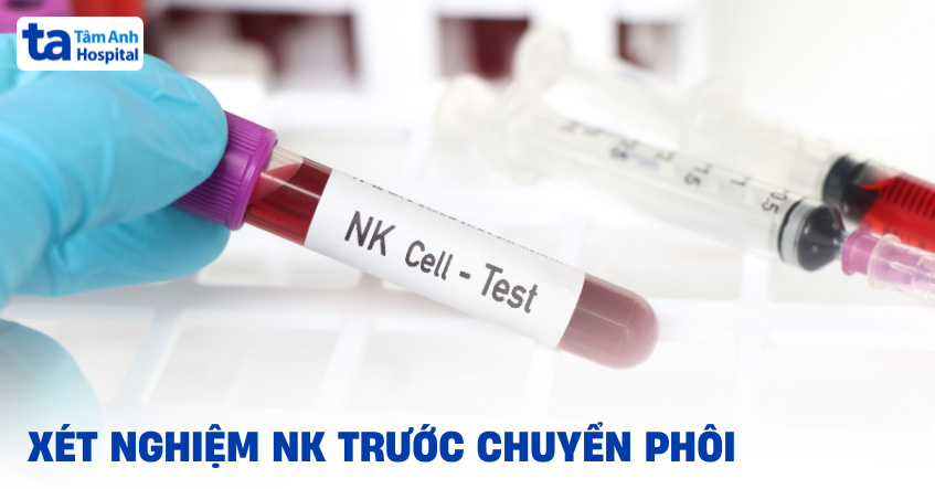 Xét nghiệm NK trước chuyển phôi để làm gì? Quy trình và lưu ý