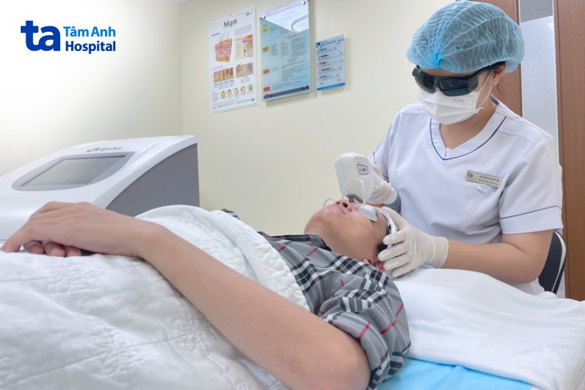 xóa nhăn trán tại bệnh việntâm anh