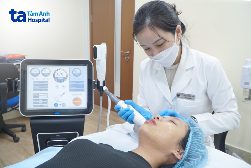 xóa rãnh cười ở đâu tốt