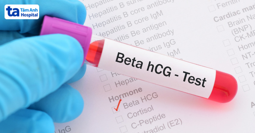 Khoảng 2 tuần sau chuyển phôi, người vợ sẽ làm xét nghiệm máu đo nồng độ beta hCG