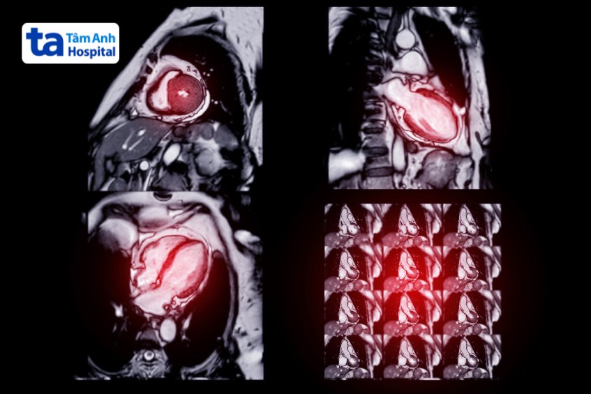 ảnh chụp mri tim