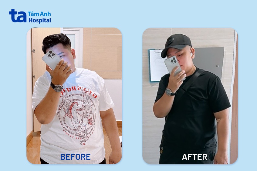 Anh H sau khi giảm cân được 22 kg