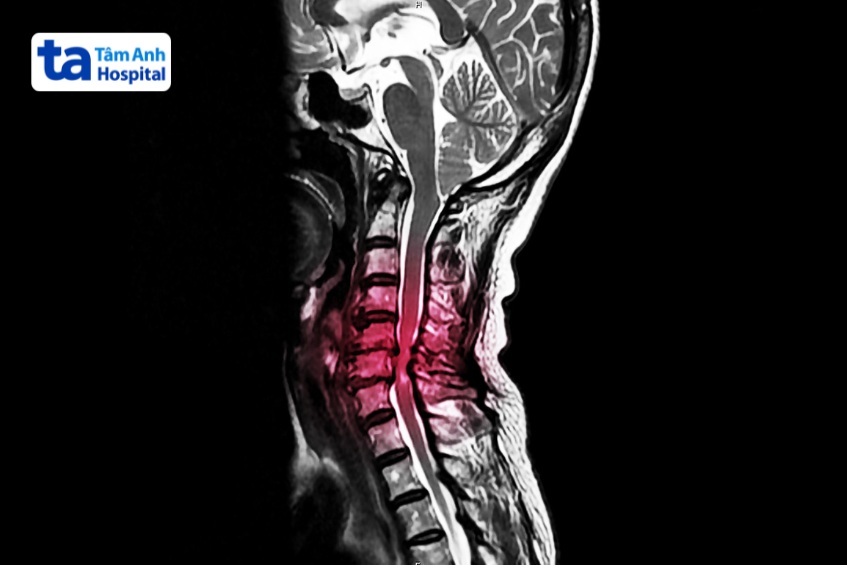 ảnh mri xương khớp