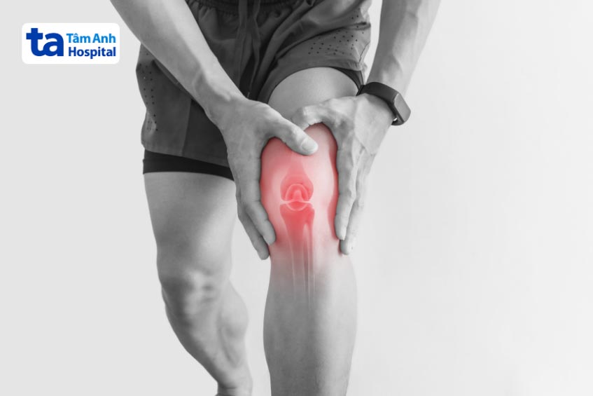 áp xe cơ gây giảm tầm vận động