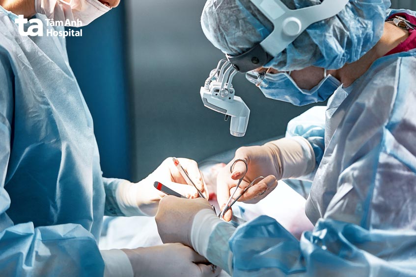 bác sĩ chuyên khoa thực hiện phẫu thuật cắt lưỡi