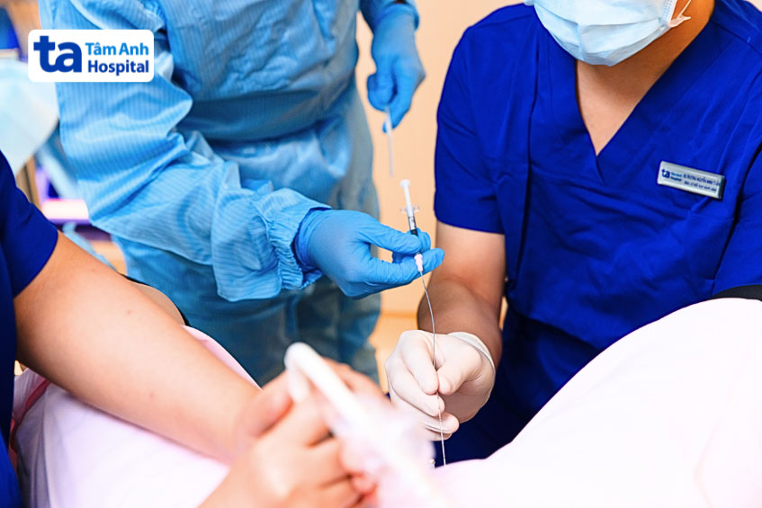 Bác sĩ thực hiện thủ thuật chuyển phôi tại IVF Tâm Anh