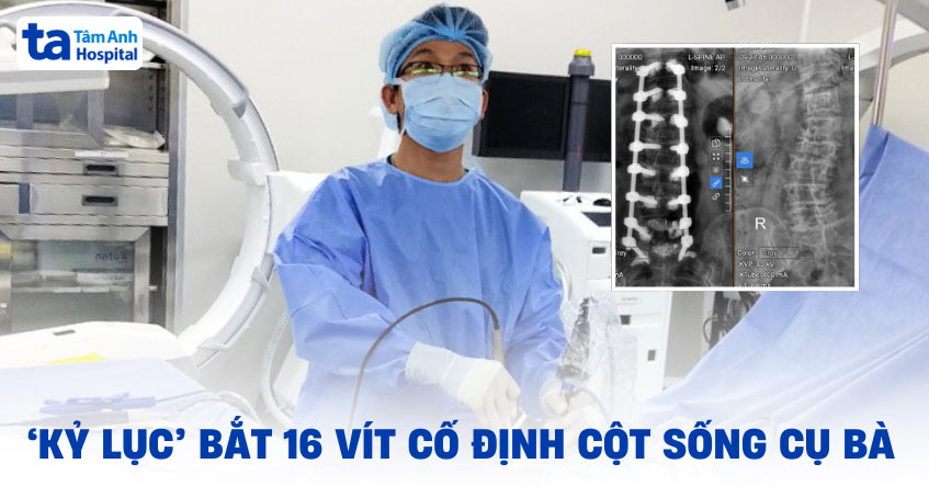 ‘Kỷ lục’ bắt 16 vít cố định cột sống cho bà cụ