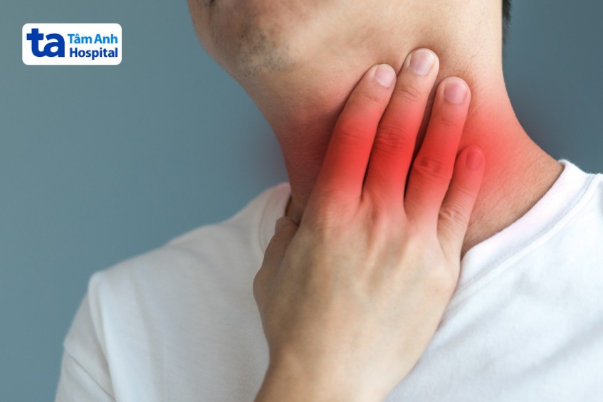 bệnh nhân có triệu chứng viêm họng nổi hạch