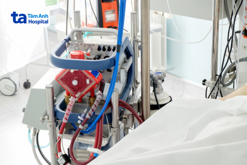 Bệnh nhân sốc tim ở giai đoạn suy yếu cần được hỗ trợ oxy hóa máu qua màng ngoài cơ thể