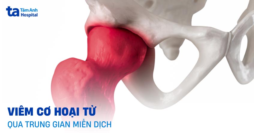 Bệnh viêm cơ hoại tử qua trung gian miễn dịch là gì?