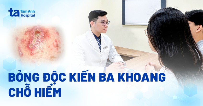 Bỏng độc kiến ba khoang chỗ hiểm