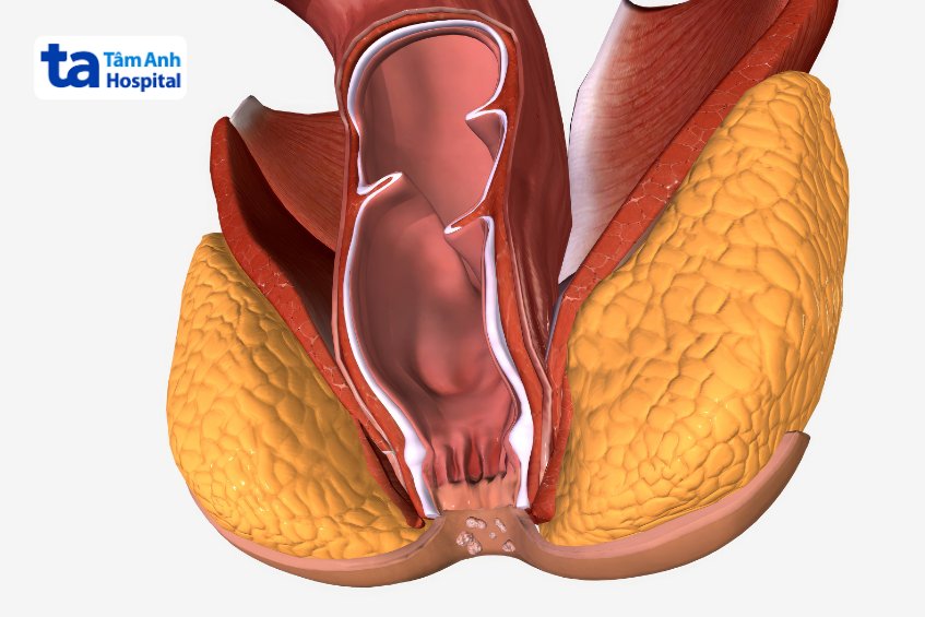 bị rò hậu môn xuyên cơ thắt