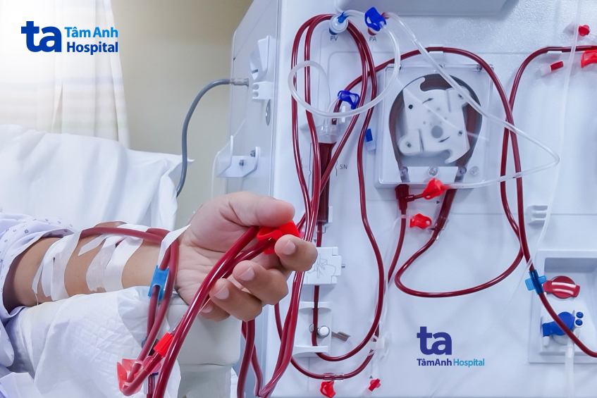 biến chứng hẹp niệu quản