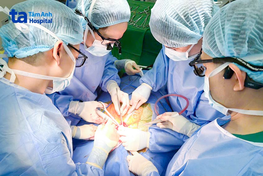 Các bác sĩ Ngoại Tim mạch - Lồng ngực mở đường cổ, cắt trọn bướu giáp lớn cho bệnh nhân