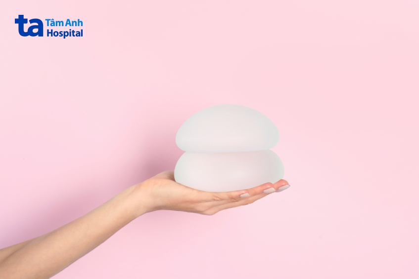 các lưu ý trước khi đặt túi ngực