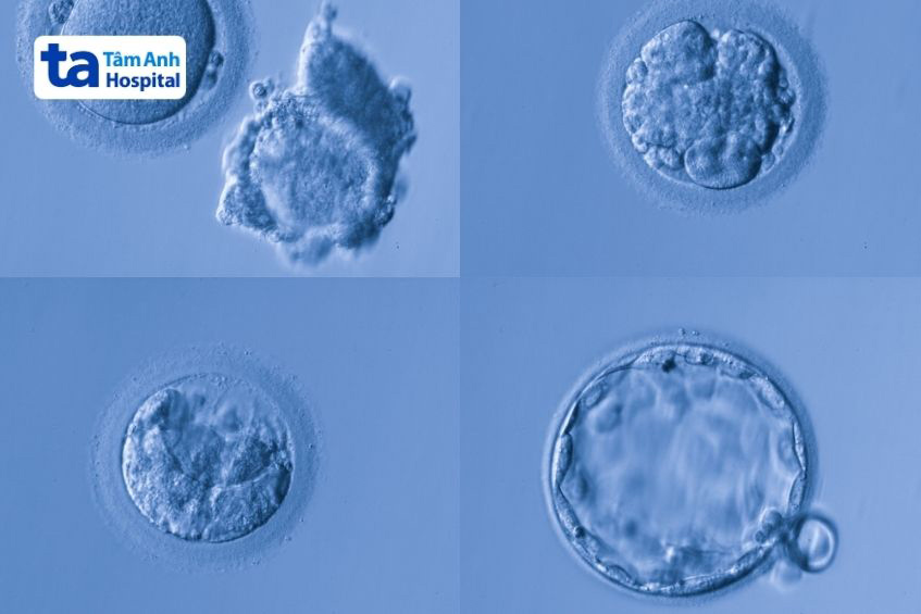 Các tế bào bên trong phôi nang bắt đầu quá trình thoát khỏi màng zona để sẵn sàng làm tổ