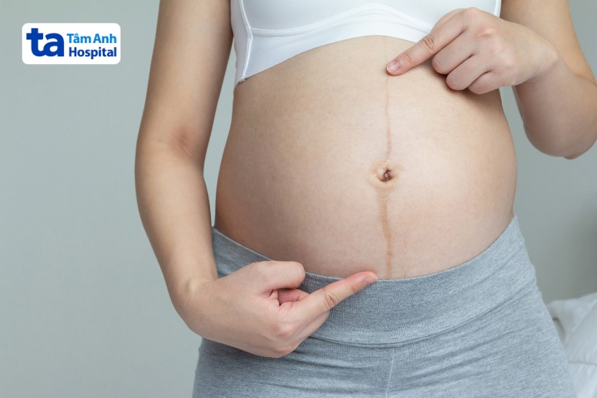 Các triệu chứng khi ở giai đoạn thai 16 tuần tuổi