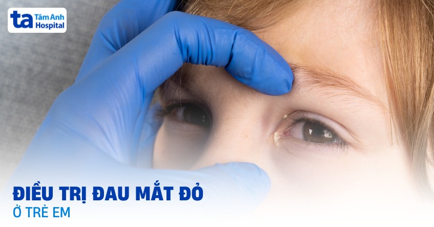4 cách điều trị đau mắt đỏ ở trẻ em hiệu quả và an toàn