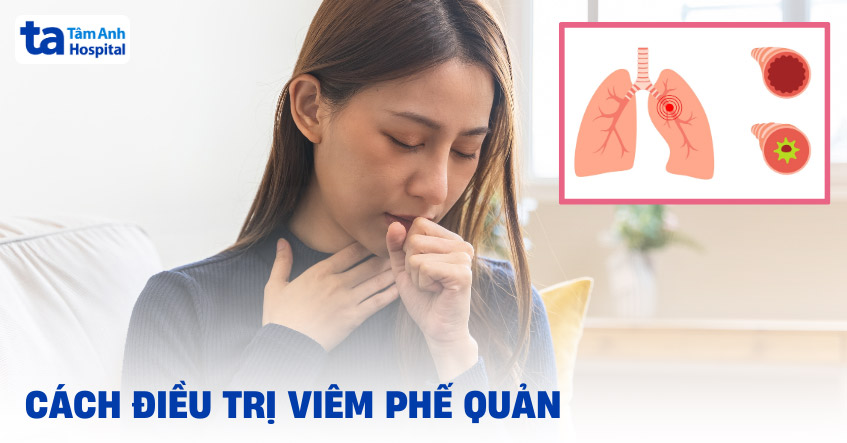 Các cách điều trị viêm phế quản hiệu quả thường được chỉ định