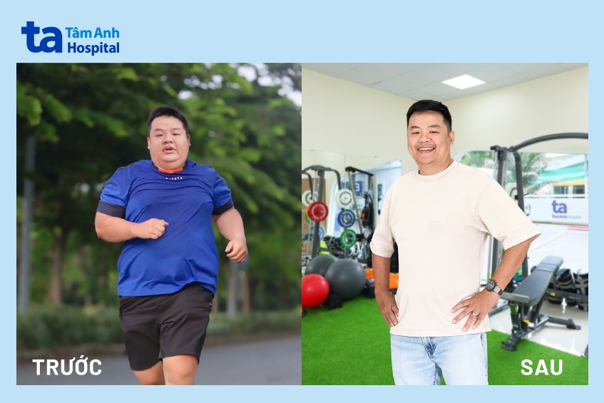 anh tuấn sau 3 tháng điều trị tại tâm anh