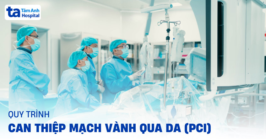 Can thiệp động mạch vành qua da (PCI): Ưu điểm, chỉ định và quy trình