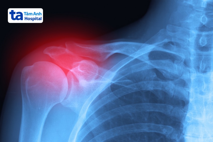 chẩn đoán hình ảnh quận 7 hcm