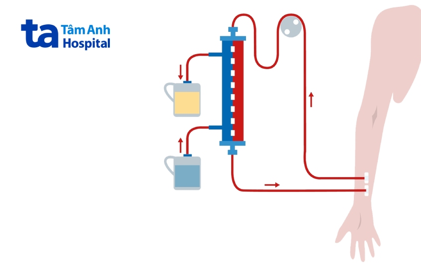 chạy thận 1 lần tốn bao nhiêu tiền