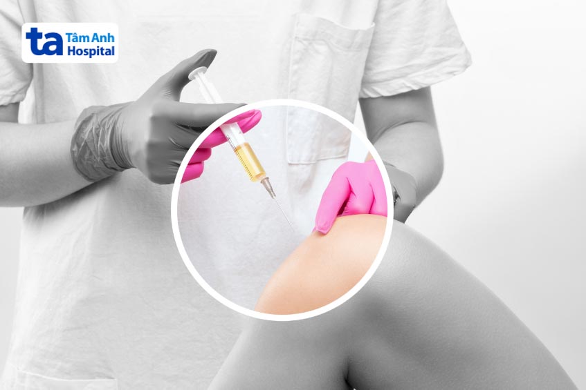 chọc hút mủ để chẩn đoán