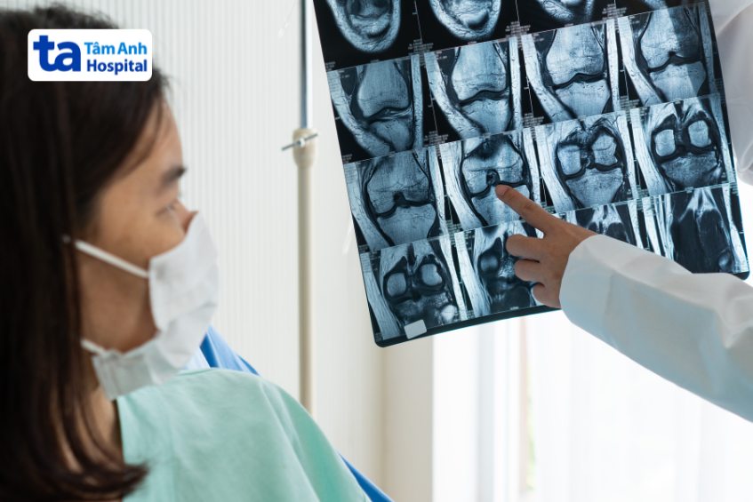 chụp cộng hưởng từ xương khớp