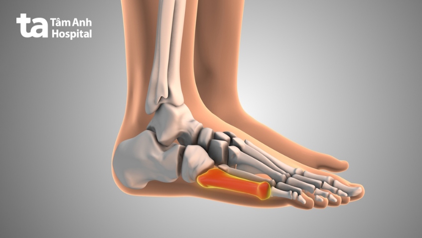 chụp ct đánh giá ung thư di căn xương.