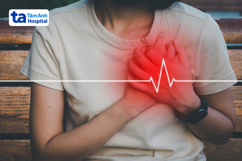 Người bệnh có thể bị rối loạn nhịp tim sau can thiệp động mạch vành qua da