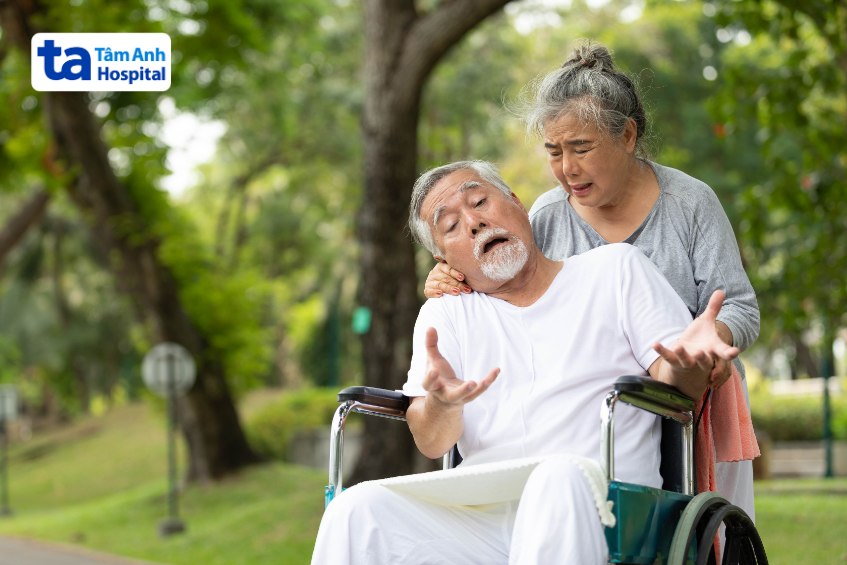 di chứng sau xuất huyết não liệt nửa người méo miệng