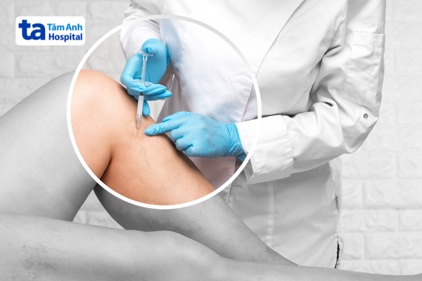 Bác sĩ thực hiện điều trị suy tĩnh mạch ngoại biên bằng cách tiêm xơ tĩnh mạch