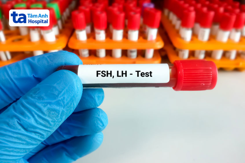 định lượng fsh và lh