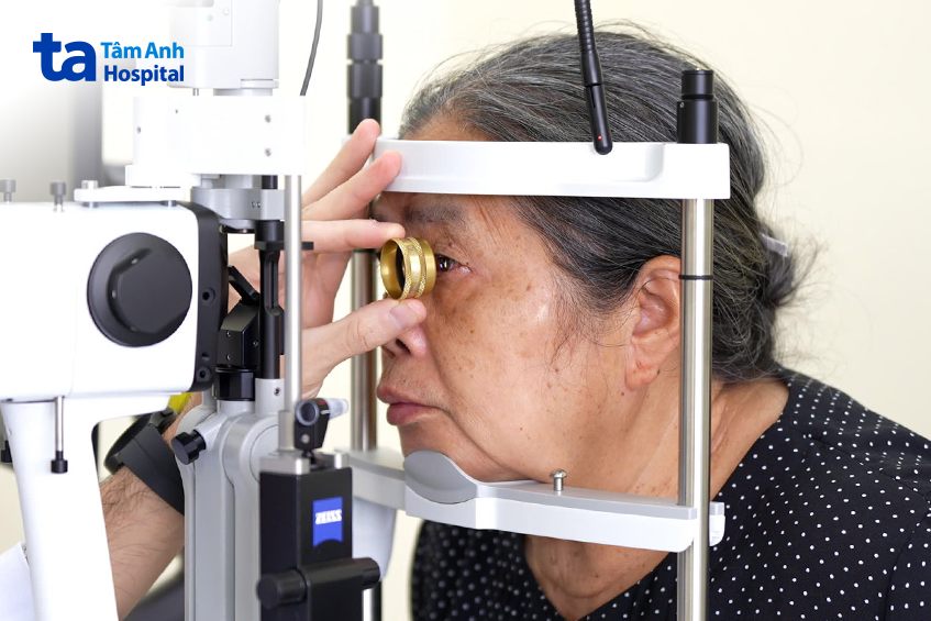 đo mắt và tìm hiểu tiền sử bệnh