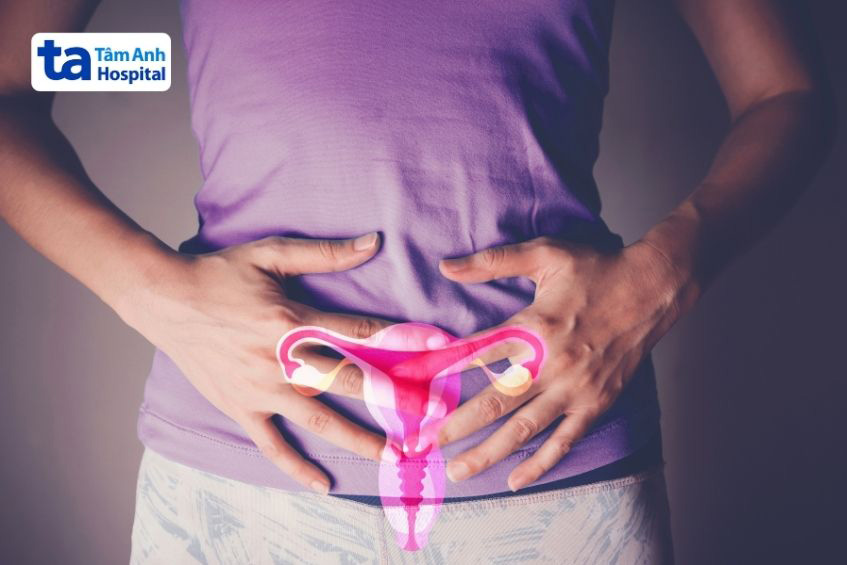 Người có giai đoạn hoàng thể dài có thể là dấu hiệu của hội chứng buồng trứng đa nang