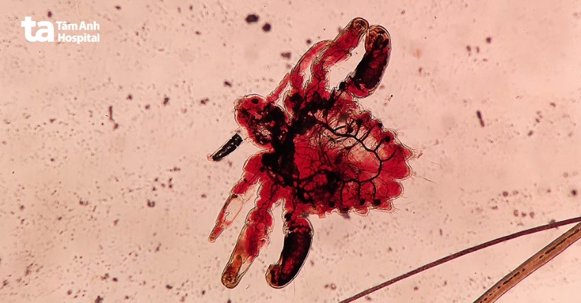 hình ảnh nhận dạng rận mu