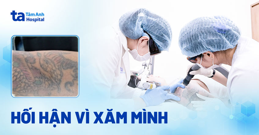 Hối hận vì xăm mình
