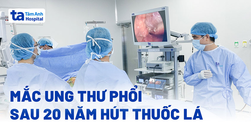 Hút thuốc lá nhiều năm, người đàn ông mắc ung thư phổi