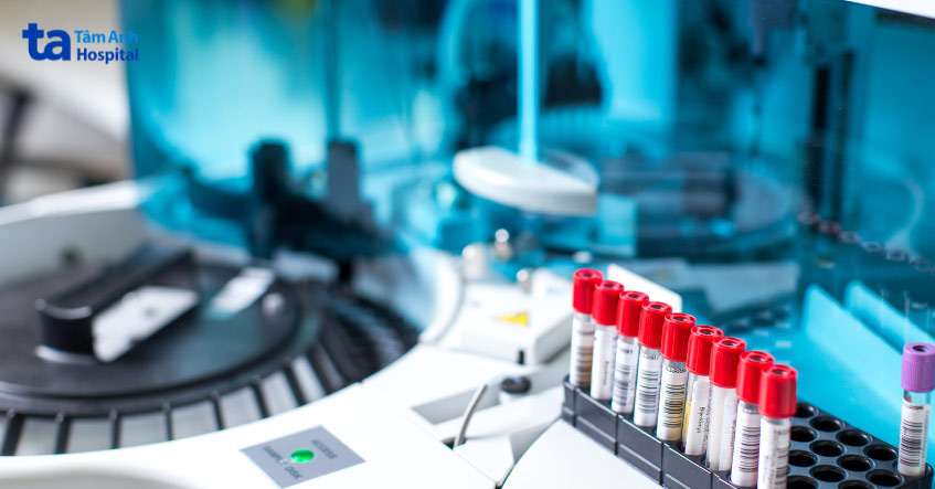 kết quả xét nghiệm máu giúp chẩn đoán nguyên nhân gây bệnh