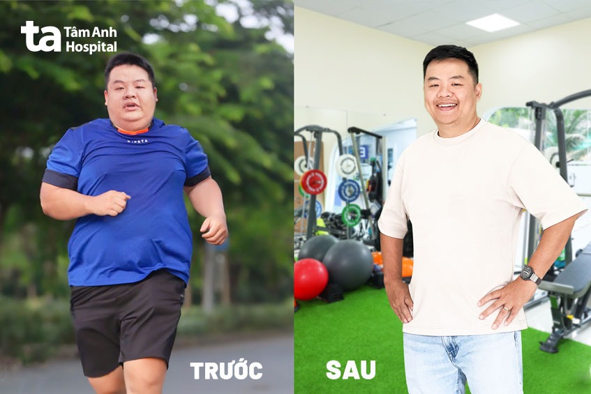 khám giảm cân ở đâu tốt Hà Nội