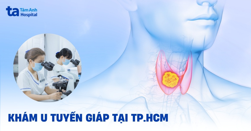 Địa chỉ khám u tuyến giáp tại TPHCM ở đâu tốt? Tiêu chí lựa chọn