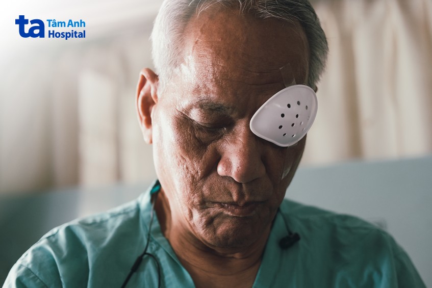 không điều trị màng trước võng mạc bằng thuốc thường