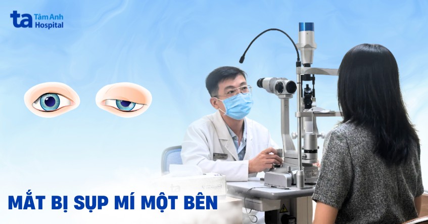 Mắt bị sụp mí 1 bên phải làm sao? 6 cách cải thiện hiệu quả