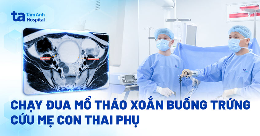 mổ khẩn trong đêm cứu thai phụ xoắn buồng trứng