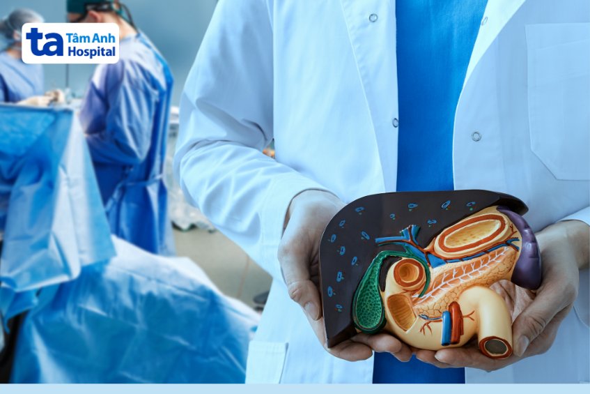 mổ nội soi cắt thân và đuôi tụy