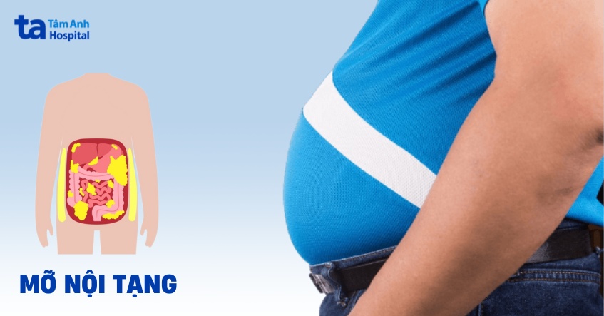 Mỡ nội tạng là gì? Nguyên nhân, nhận biết và chăm sóc phòng ngừa